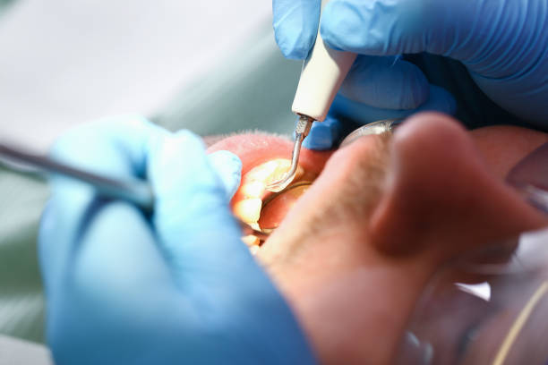 Best Emergency Treatment for Toothache in Morgantown, KY