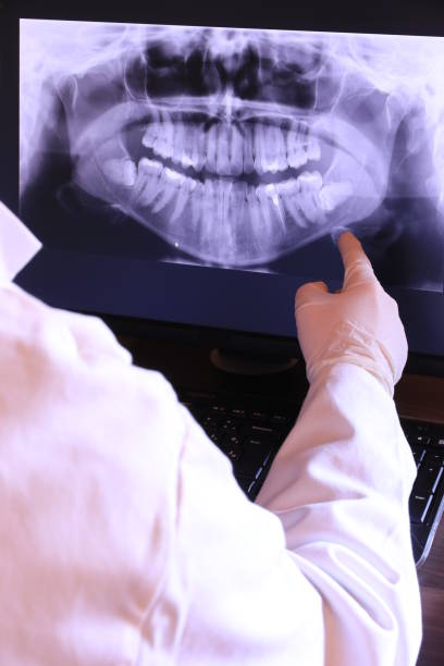 Best Emergency Tooth Extraction in Morgantown, KY